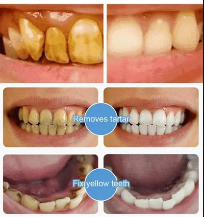 Beamach Hydroxyapatite® - Blanqueamiento Y Protección Del Esmalte 120 ml